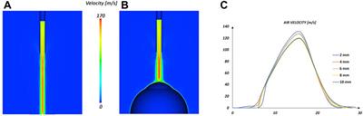 A detailed methodology to model the Non Contact Tonometry: a Fluid Structure Interaction study